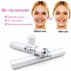 Destroy Breakouts in 48 Hours — The Portable Blue Light Acne Pen That Actually Delivers