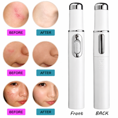 Destroy Breakouts in 48 Hours — The Portable Blue Light Acne Pen That Actually Delivers