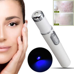 Destroy Breakouts in 48 Hours — The Portable Blue Light Acne Pen That Actually Delivers